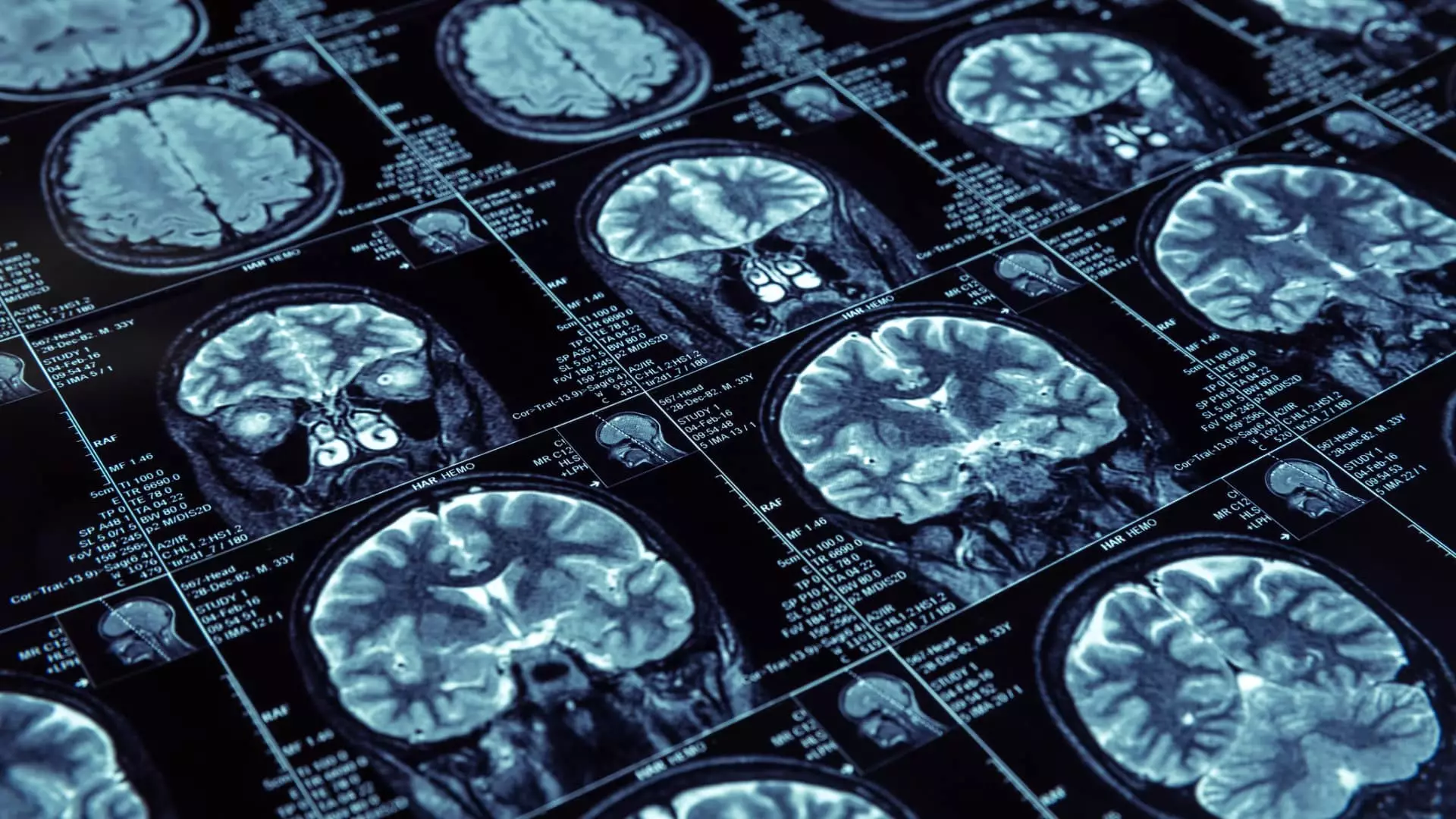 Exploring the Implications of Neurotechnology and Consumer Privacy