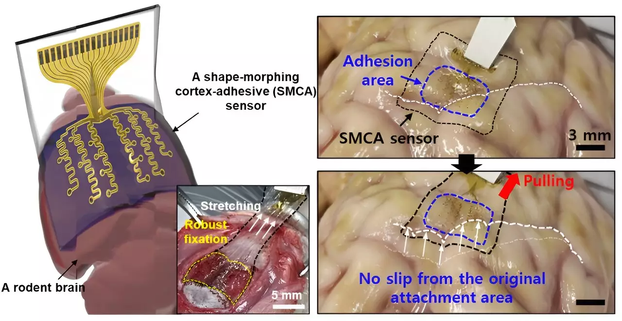 Revolutionizing Neurological Treatments: The Promise of Transcranial Focused Ultrasound and Innovative Brain Sensors